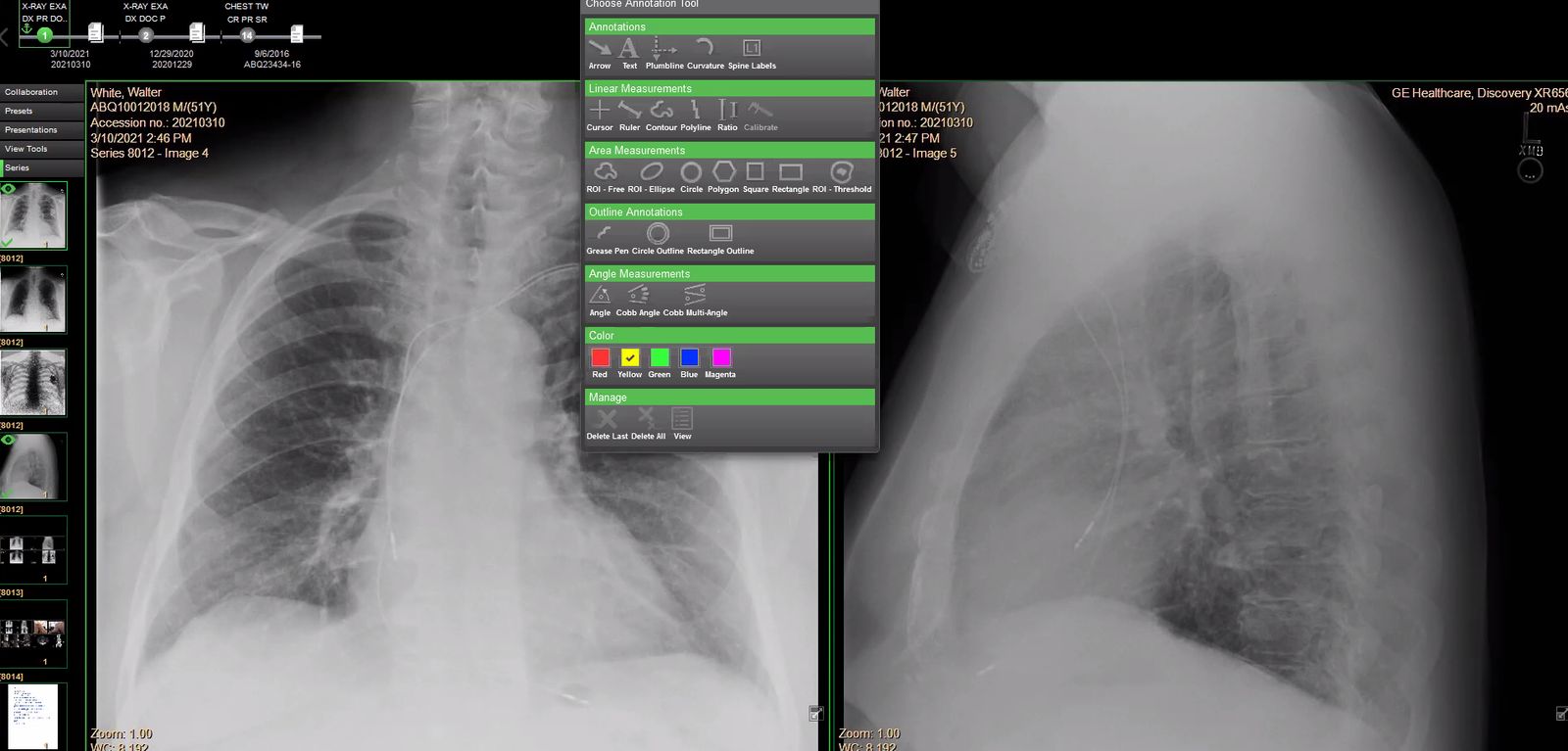 A measurement toolkit that rivals the workstation